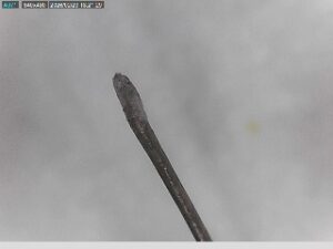 毛根から原因を調べる