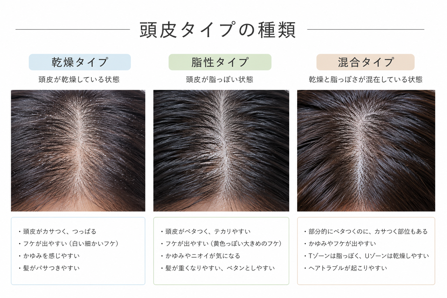 頭皮タイプ別ケア完全ガイド しゅくるithnani