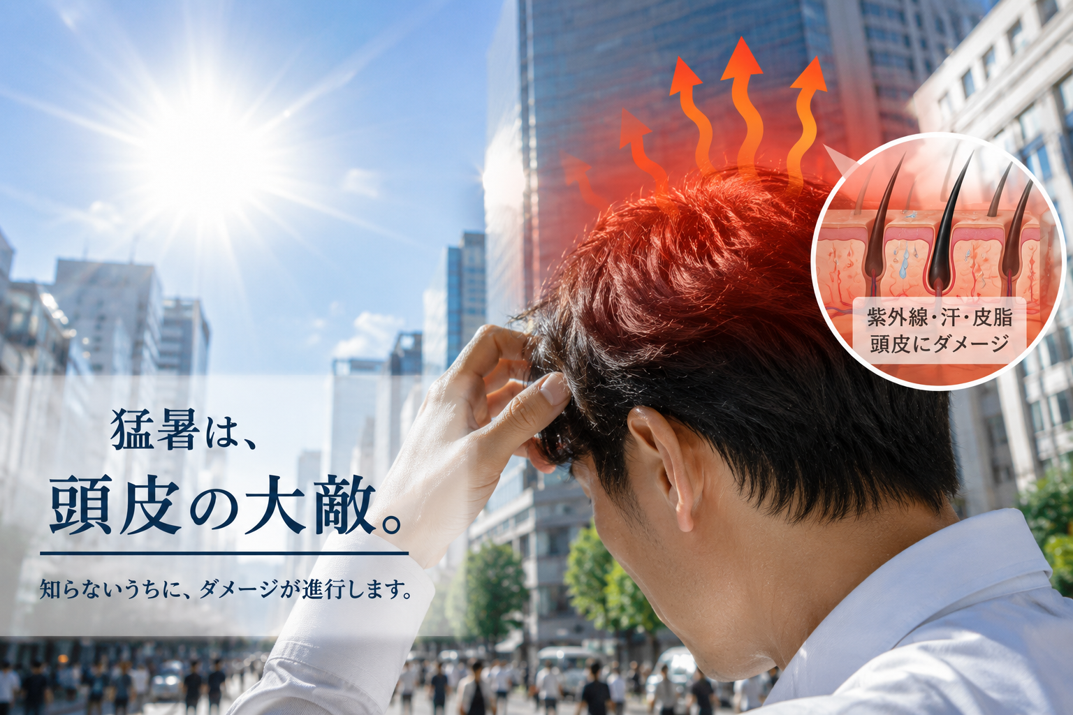 記録的猛暑と頭皮への影響イメージ